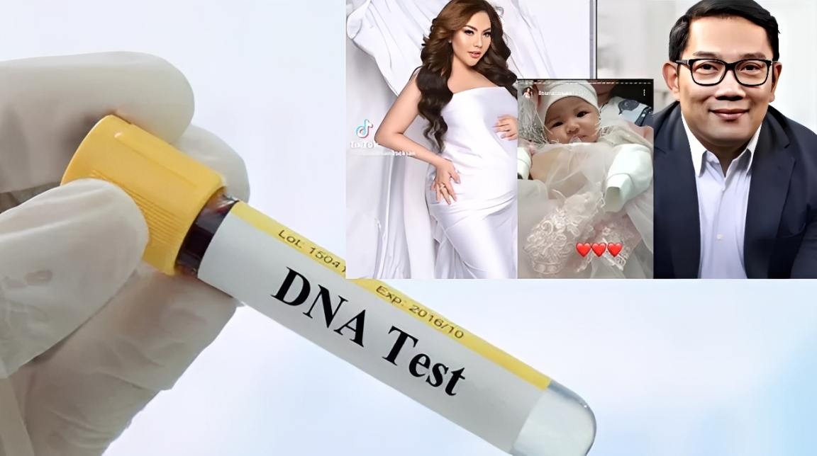 Hasil Tes DNA RK-LM Dinyatakan Ilmiah, Bareskrim Pastikan Tidak Ada Kecocokan Genetik